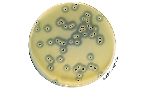 Baird-Parker Agar With Egg Yolk Tellurite