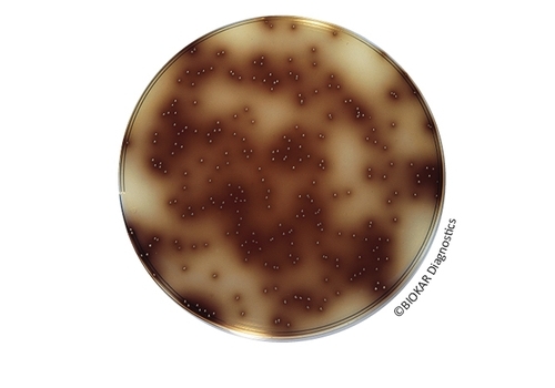 Bile Esculin Azide Agar (BEA agar)