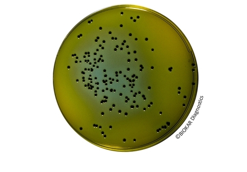 Hektöen Enteric Agar