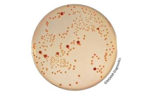 MacConkey Sorbitol (CT-SMAC) Agar