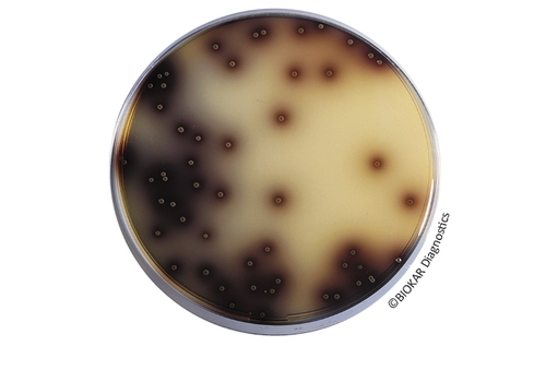 Oxford Agar