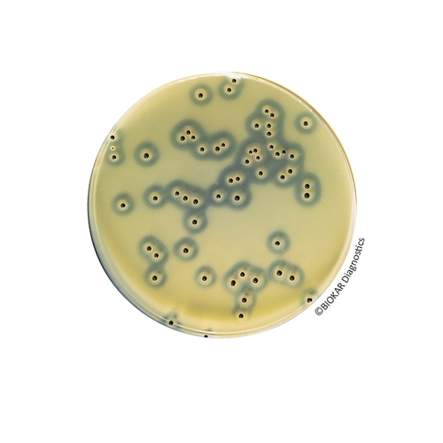 Baird-Parker Agar With Egg Yolk Tellurite