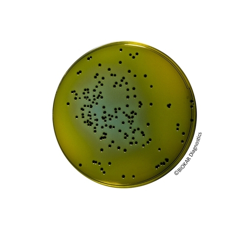 Hektoen Enteric Agar