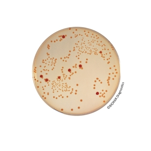 MacConkey Sorbitol (CT-SMAC) Agar