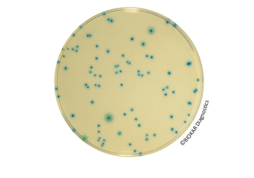 TRYPTONE-BILE-X-GLUCURONATE (TBX) AGAR