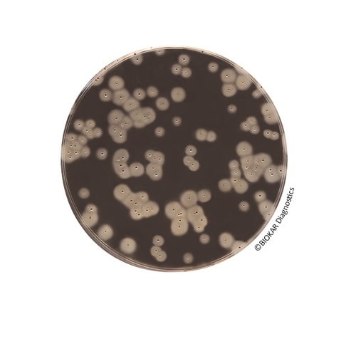 EASY STAPH Agar (RTU)