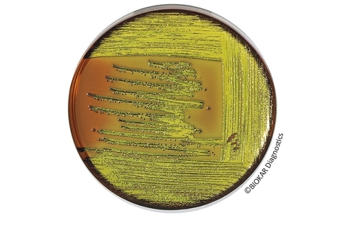 EMB Agar