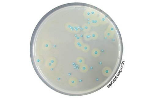 COMPASS® Listeria Agar Kit